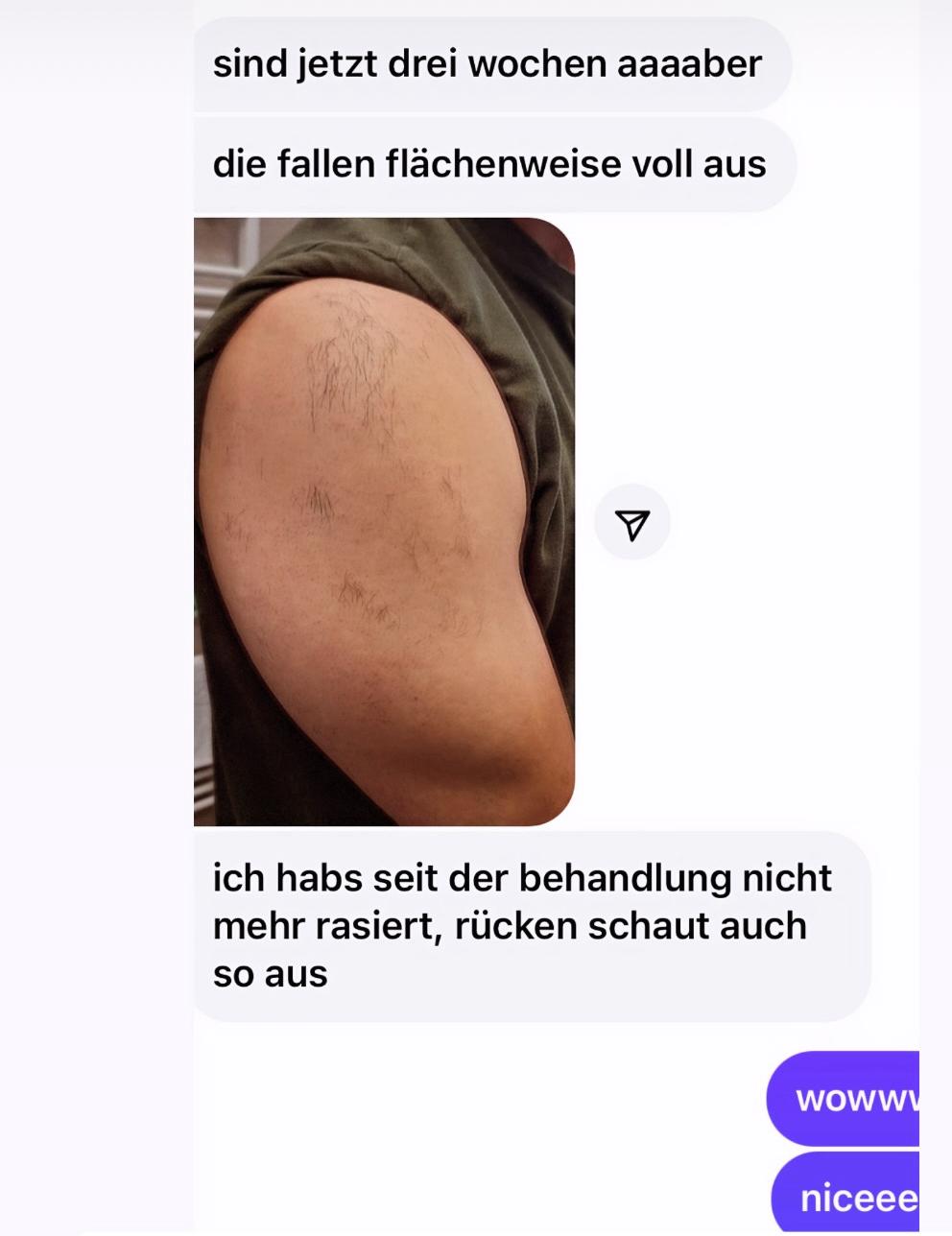 Kundenfeedback LaserLux weniger Haare